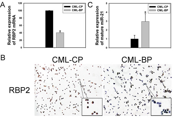 The expression of RBP2 and miR-21 in 26 patients with chronic myeloid leukemia in the chronic phase (CML-CP) and in 18 with blastic phase (CML-BP).