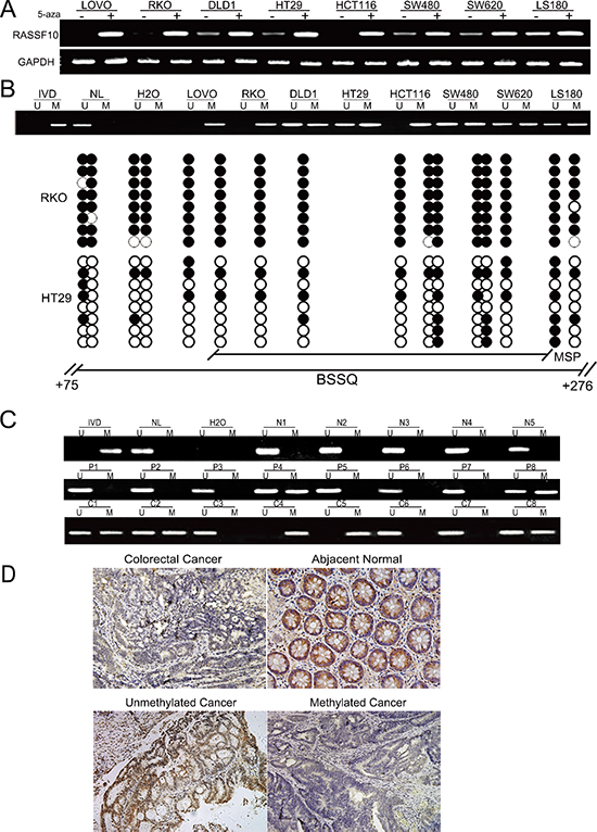 RASSF10 expression is regulated by promoter region hypermethylation in colorectal cancer.