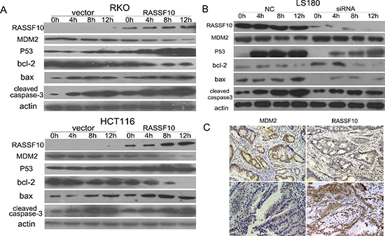 RASSF10 effects on P53 signaling.