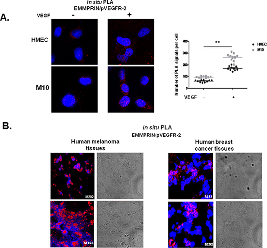 EMMPRIN interacts with pVEGFR-2 in vitro and in vivo.