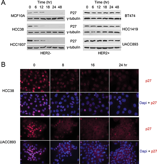 P27 mis-localizes to the cytoplasm in HER2+ breast cancer cells.