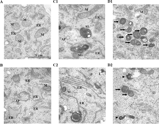 Changes in the ultrastructure of autophagic structures in HEI-OC1 cells treated with H2O2 briefly.