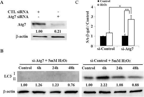Atg7-knockdown associated autophagy impairment induces premature senescence in HEI-OC1 cells.