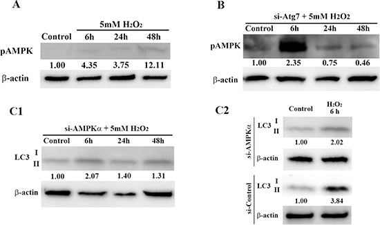 Interaction between autophagy and AMPK signaling pathways in HEI-OC1 cells.