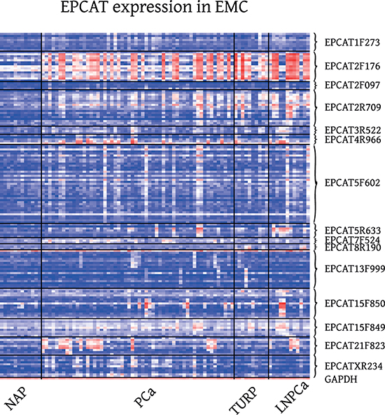 Expression of 15 RT-PCR validated EPCATs in EMC Exon Array samples.