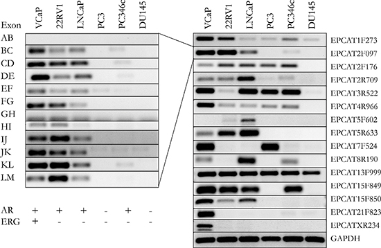 Validation of 15 EPCATs in 6 prostate cancer cell lines.