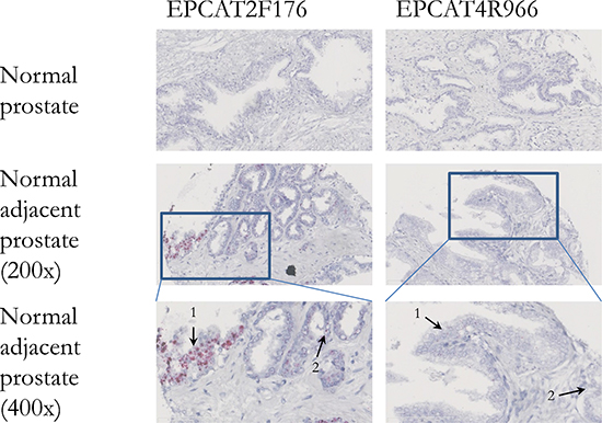 In situ hybridization of two EPCATs in normal prostate tissues.
