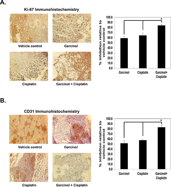 Garcinol enhances the effect of cisplatin against biomarkers of proliferation and angiogenesis in HNSCC cells.