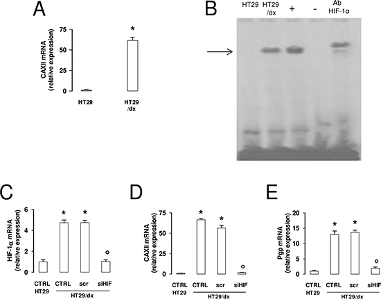CAXII and Pgp expression levels are affected by HIF-1&alpha; in chemoresistant cells.