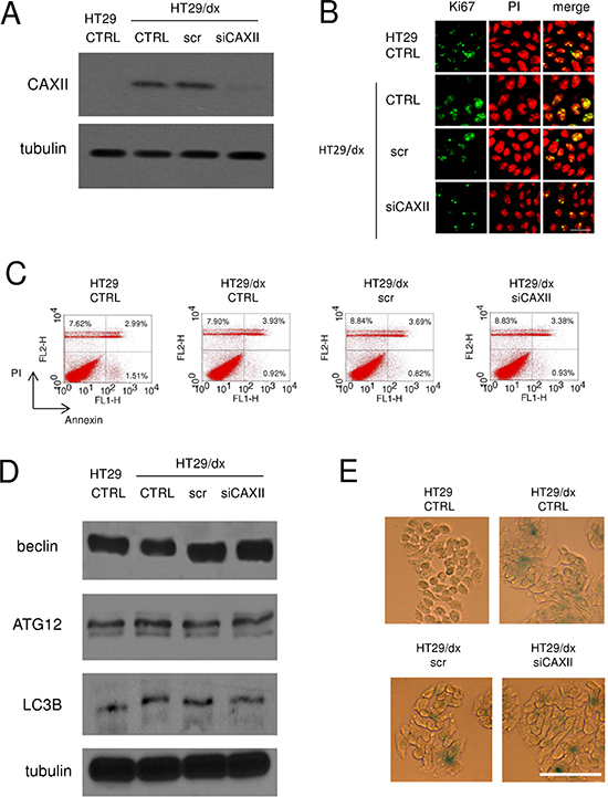 Depletion of CAXII does not affect proliferation and survival of chemoresistant cells.