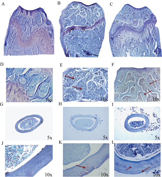 p62 DNA prevents osteoporosis.