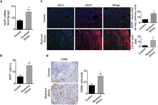 Daily restraint stress leads to increased MCP1 expression and infiltration of CD14+ and CD68+ cells.