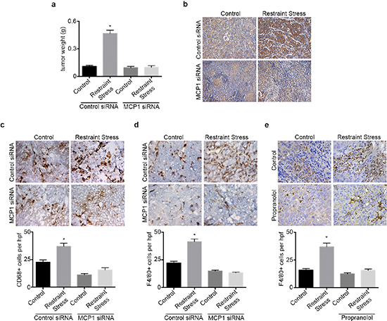hMCP1 siRNA-DOPC nanoparticles abrogates restraint stress induced increase in tumor growth and macrophage recruitment.