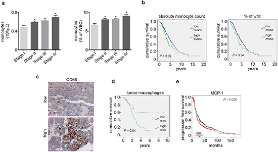 Elevated peripheral blood monocytes and tumoral macrophages correlate with poor outcome in ovarian cancer patients.