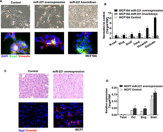 EMT participate in the regulation of miR-221 in normal and malignant breast cells.