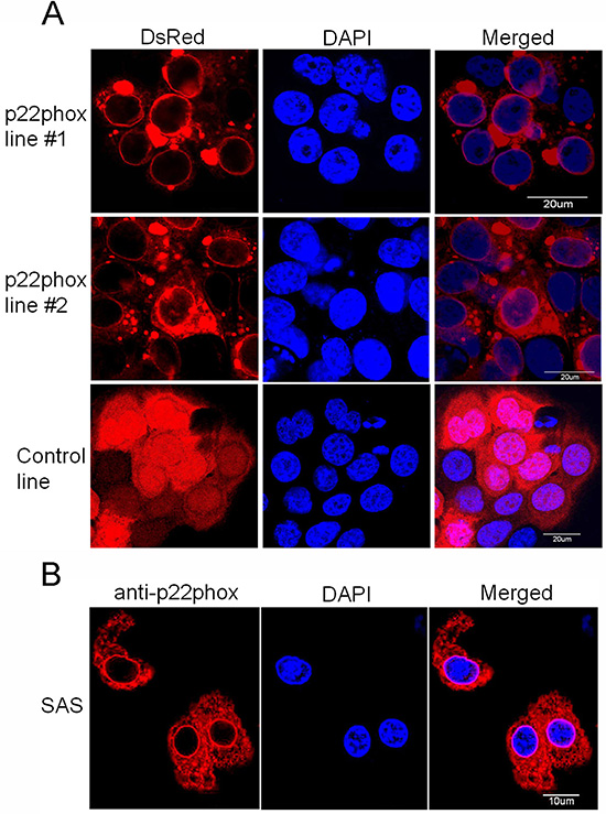 Overexpression of p22phox led to its perinuclear localization in OSCC cells.