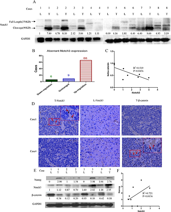 Notch3 signaling activation is negatively associated with &#x03B2;-catenin in HCC tissues.