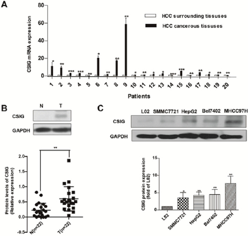 Increased expression of CSIG in HCC is associated with MYC protein.