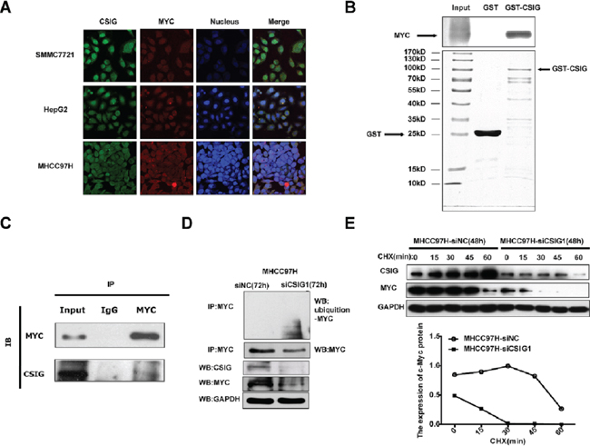 CSIG interacted with MYC in vitro and in vivo, and knockdown of CSIG promoted MYC protein degradation.