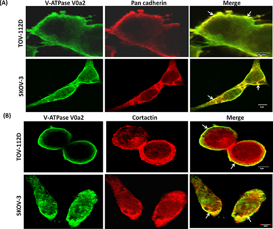 V-ATPase-V0a2 isoform exhibits association with invasion associated proteins on ovarian cancer cell surface.