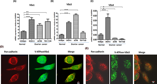 Expression profiling of V-ATPase &#x2018;a&#x2019; subunit isoforms in ovarian cancer.