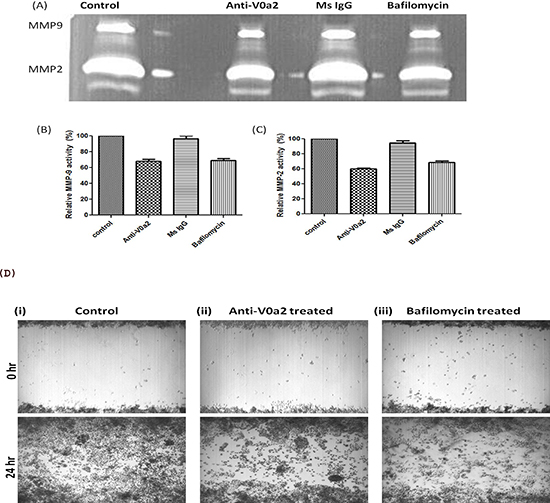 Inhibition of V-ATPase V0a2 decreases MMP-9 expression in ovarian carcinoma cells.