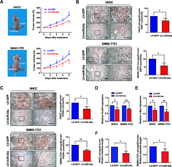Administration of miR-34a with lentivirus suppresses cancer cell growth in vivo.