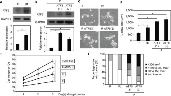 ATF5 promotes cell growth.