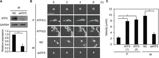 Invasiveness is dependent on ATF5 expression.