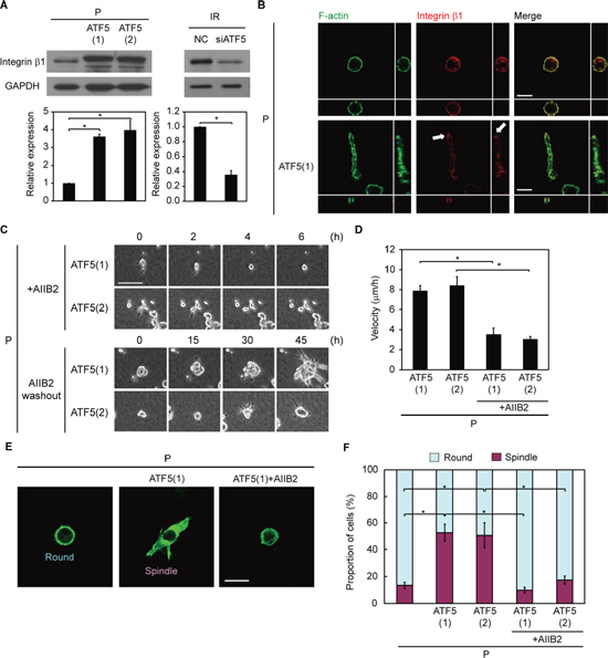 ATF5 induces integrin &#x03B2;1 expression, promoting invasiveness.