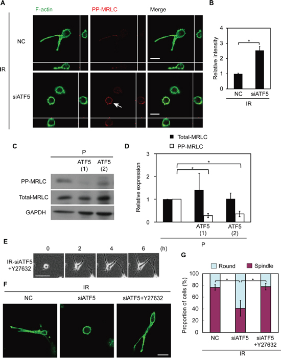 ATF5 perturbs the diphosphorylation of myosin regulatory light chain (MRLC), impairing invasiveness.