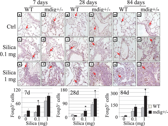 Increased Treg cells in the lung tissues of the mdig+/&#x2212; mice.