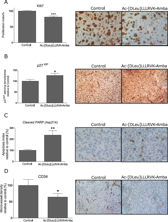 Immunohistochemistry analyses on harvested tumors.