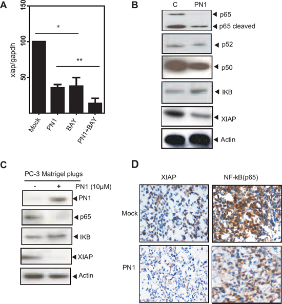PN1 influences NF-&#x03BA;B-mediated regulation of XIAP in prostate tumor cells.