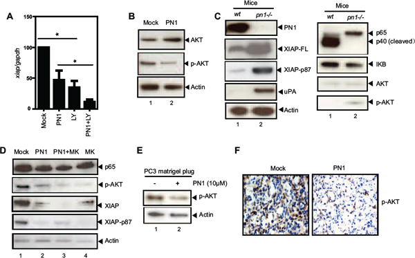 PN1 mediates XIAP stability in prostate cancer cells.