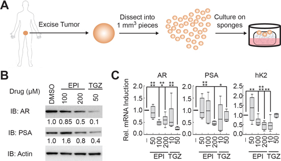 EPI-001 and troglitazone inhibit AR expression and activity in clinical prostate cancer tissues.