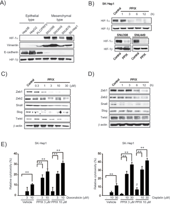 Inhibition of EMT markers by PPIX in mesenchymal cancer cell lines.