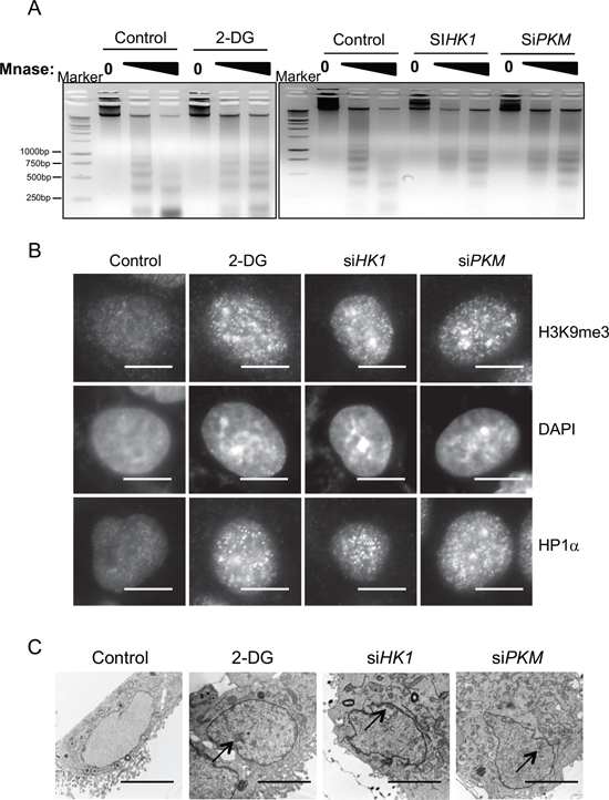 Glycolytic metabolism stimulates open global chromatin structure.