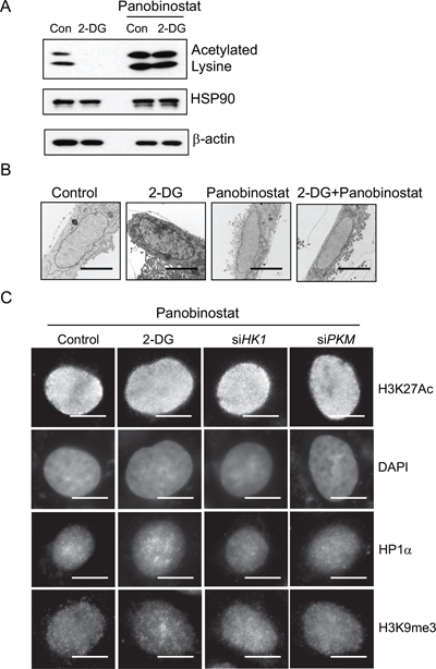 Role of histone acetylation in regulating glycolysis induced chromatin structure changes.