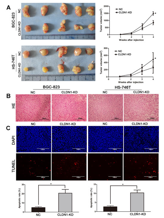 Knockdown of CLDN1 suppressed tumorigenesis and increased apoptosis