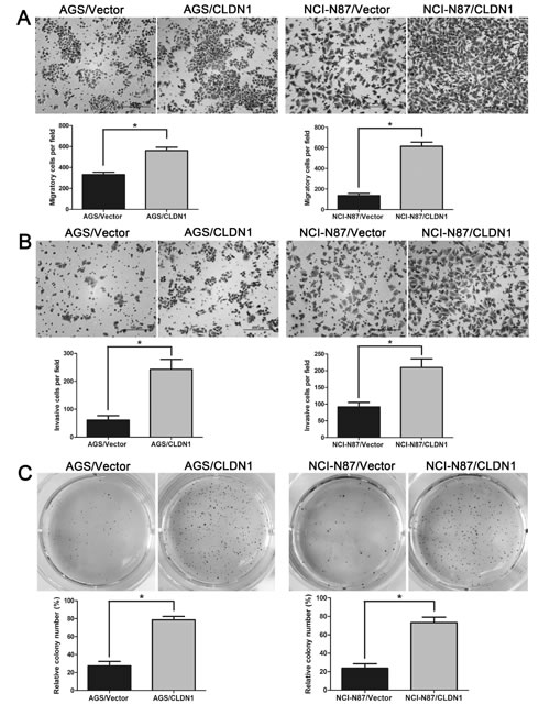 Overexpression of CLDN1 in gastric cancer cells AGS and NCI-N87 enhances cell migration and invasion