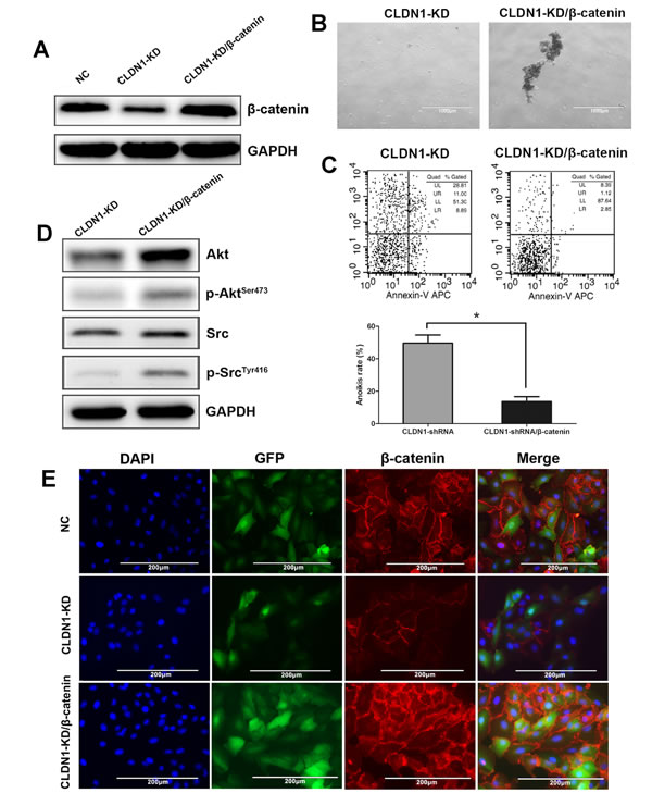 Overexpression of &#x3b2;-catenin in CLDN1-KD cell of HS-746T restored cell aggregation, anoikis resistance and survival signals of Akt and Src activation.