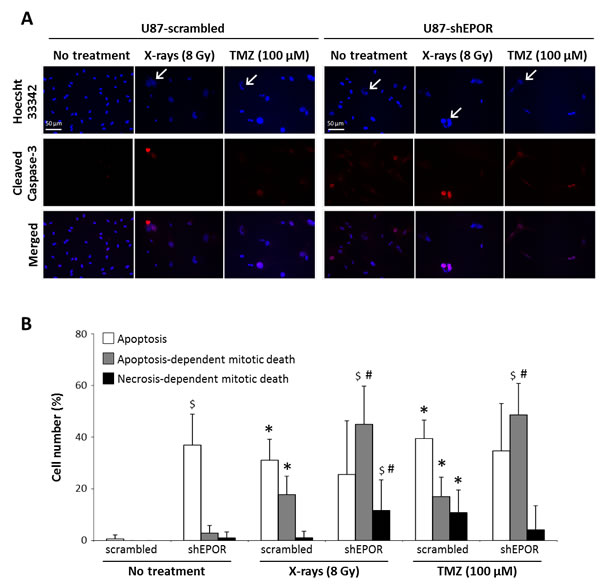Apoptosis-dependent mitotic death induced by X-rays treatment or temozolomide exposure is potentiated by EPOR inhibition on glioma cells.