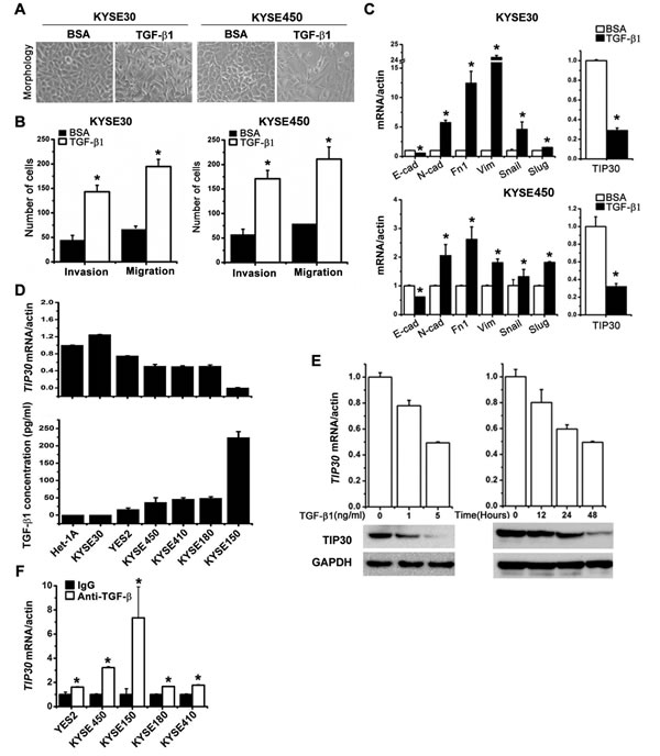 The reverse correlation of TIP30 and TGF-&#x3b2;1 levels in ESCC cell lines.