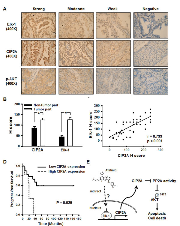 Cancerous inhibitor of protein phosphatase 2A (CIP2A) expression in 49 non-small cell lung cancer patients.