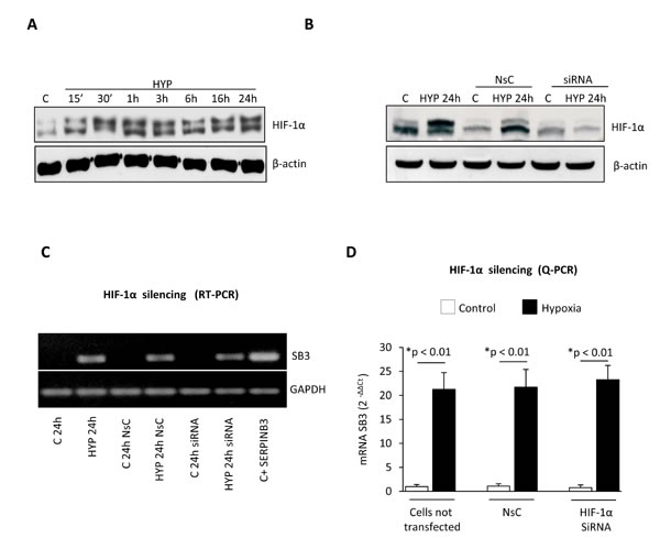 Hypoxia-dependent SERPINB3 (SB3) up-regulation is unrelated to HIF-1&#x3b1;.