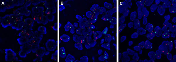 Fibroblast growth factor receptor 1 (