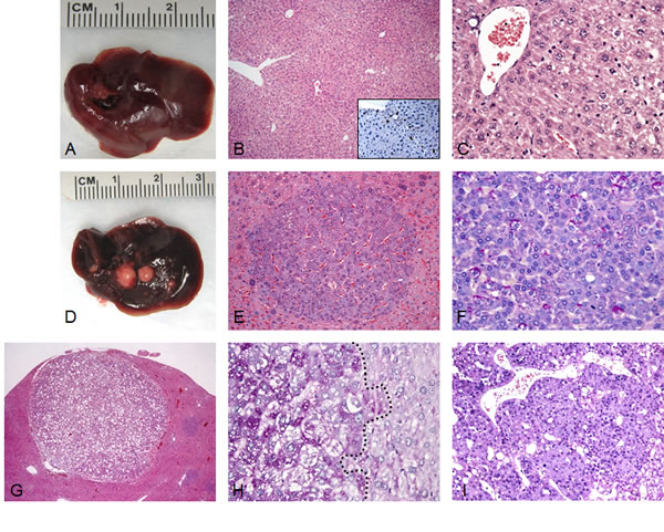 Liver tumor development in SKP2/N-RasV12 mice by hydrodynamic gene delivery.