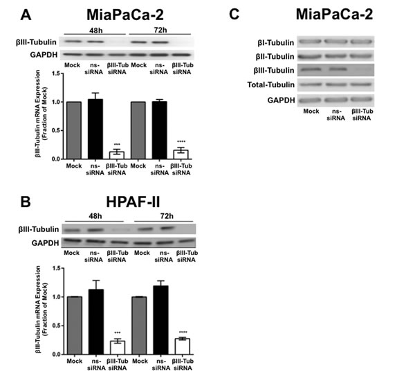 FIGURE 2: &#x3b2;III-tubulin silencing in pancreatic cancer cell lines.