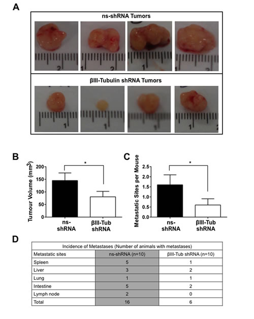 FIGURE 8: The effect of &#x3b2;III-tubulin silencing on orthotopic tumor growth and metastases.